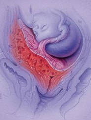 前置胎盤の問題